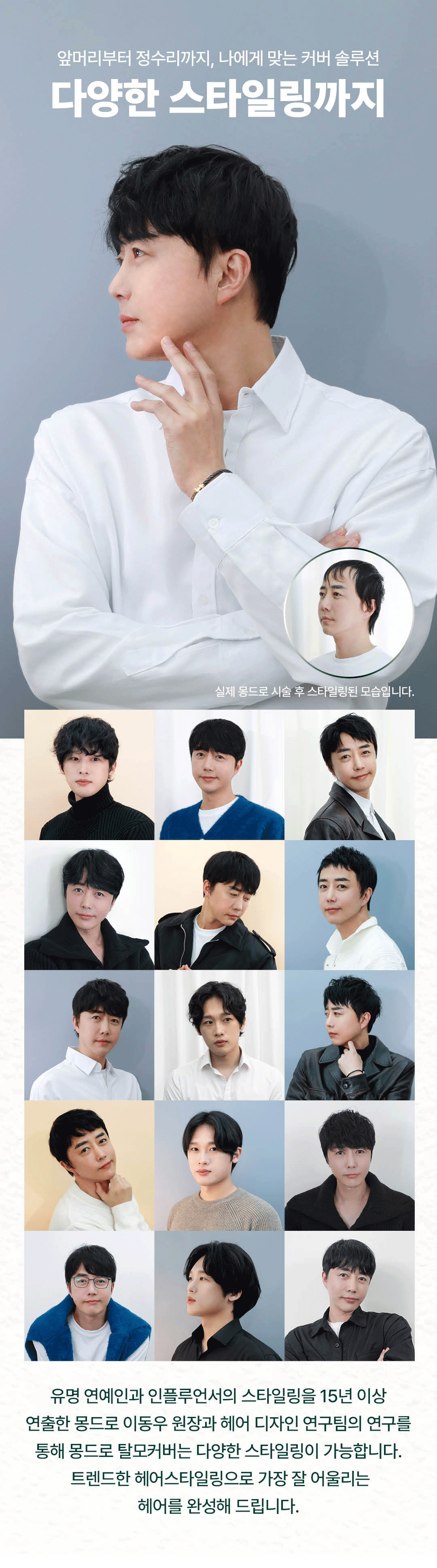 남성 탈모 시술 관련 이미지 10