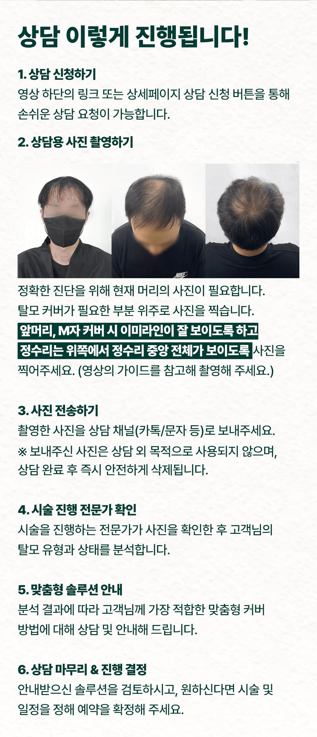 남성 탈모 시술 관련 이미지 17